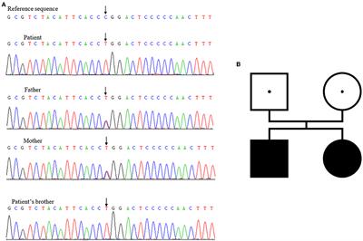 Congenital Isolated ACTH Deficiency Caused by TBX19 Gene Mutation: A Family Report